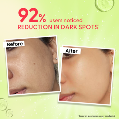 Fast&Up Outshine Korean Face Serum – Fades Dark Spots & Brightens Skin with Glutathione, Niacinamide & Vitamin C