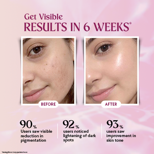 Fast&Up Chicnutrix Glow Advanced – Liposomal Glutathione, Ergothioneine & Strong Antioxidant Formula for Uneven Skin Tone